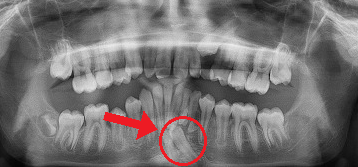 Orem Orthodontist team in Orem, Utah