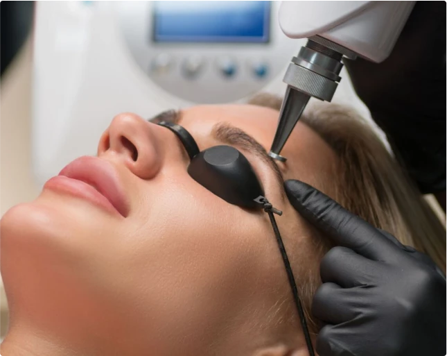 Détatouage des sourcils