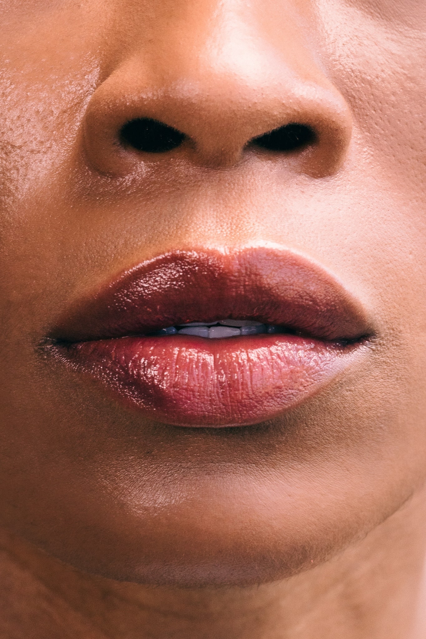 Do Fillers Really Stay in Your Face Forever? Debunking the Most Common Myths About Dermal Fillers