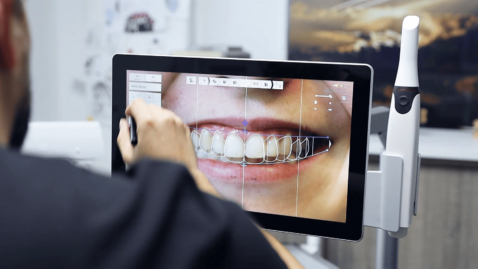 Digital smile design