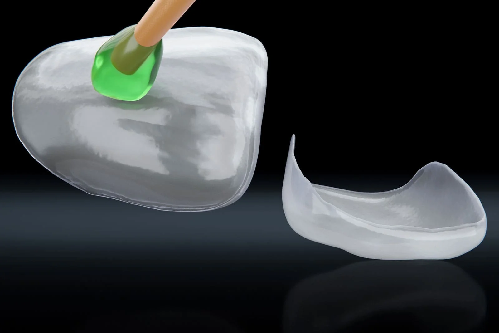 Close-up of E-Max veneers showing natural translucency