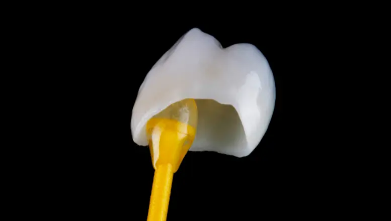 Dental crown structure covering the entire tooth for strength and protection