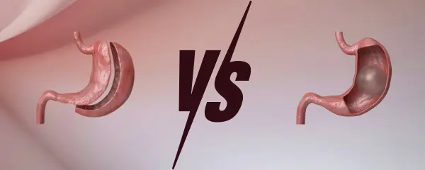 Lose 20–30kg in Turkey: Gastric Balloon vs Sleeve Surgery | Cost, Safety & Results