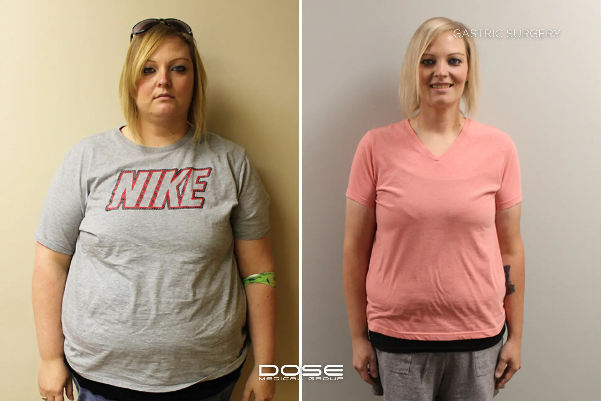 Real patient journeys highlight the emotional and physical transformation possible through bariatric procedures in Turkey.