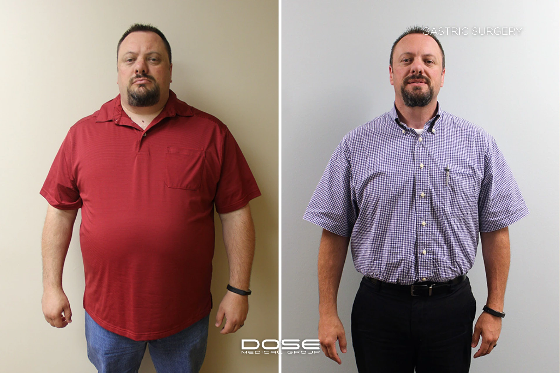 Real patient journeys highlight the emotional and physical transformation possible through bariatric procedures in Turkey.