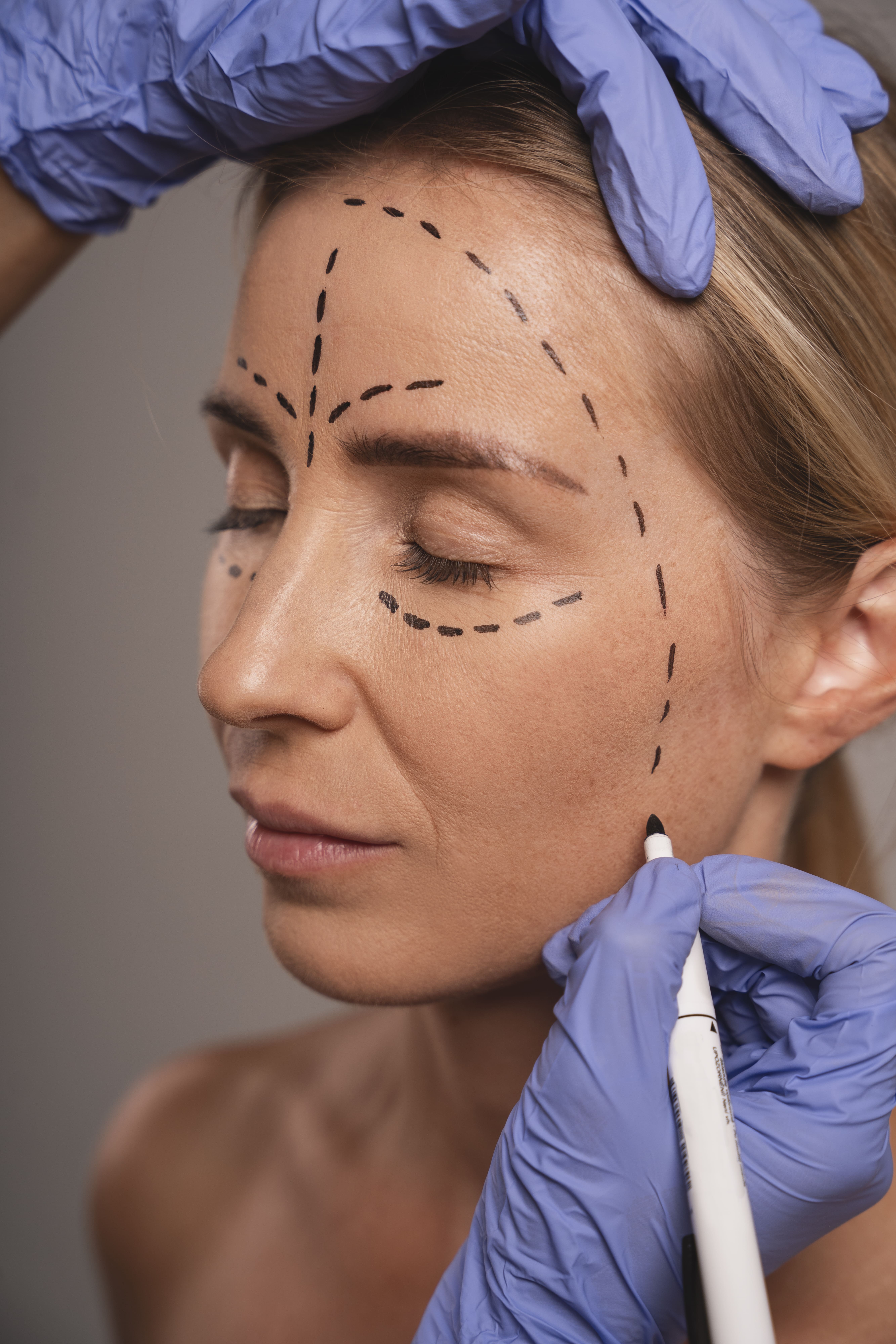 Plastic Surgery
