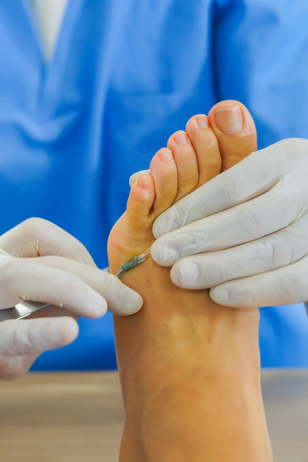 Doctor in white gloves examines patient's foot.