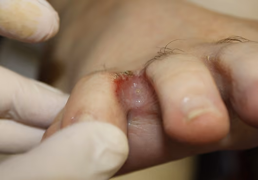 A doctor scrutinizes a patient's foot.