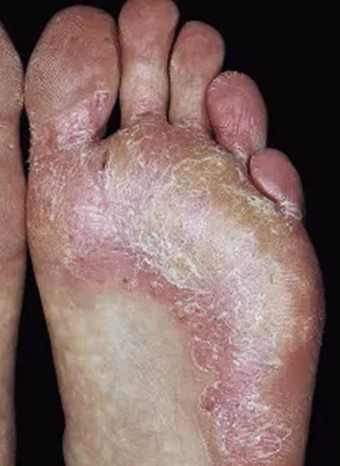 A doctor scrutinizes a patient's foot.