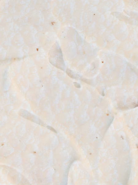 Clumpy, white cottage cheese-like texture similar to yeast infection discharge