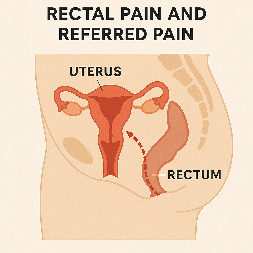 Illustration of the uterus and rectum placement in the body, with the copy "Rectal pain and referred pain"
