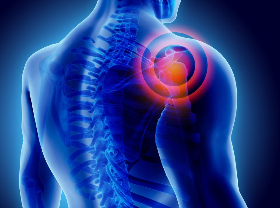 Anatomical illustration highlighting shoulder joint pain