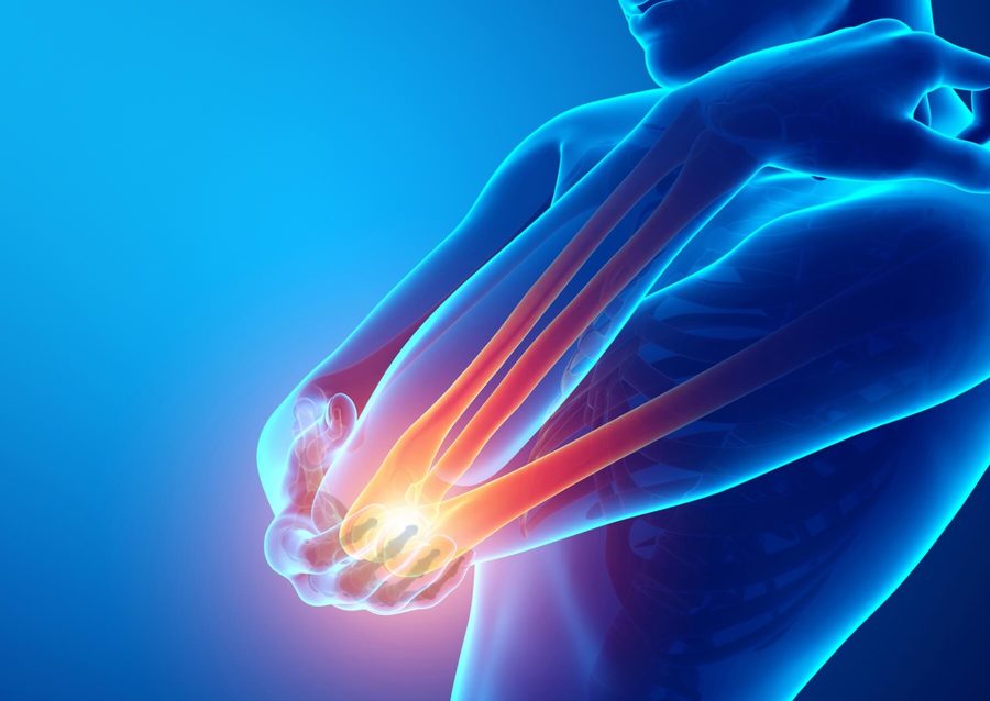 Anatomical illustration of the elbow joint and tendons