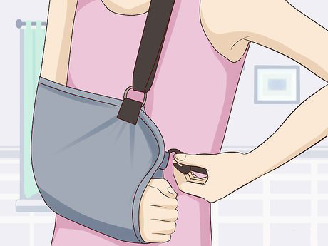 Illustration of a person wearing an arm sling for shoulder support