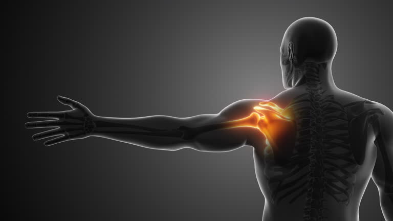 Medical illustration showing shoulder pain and inflammation