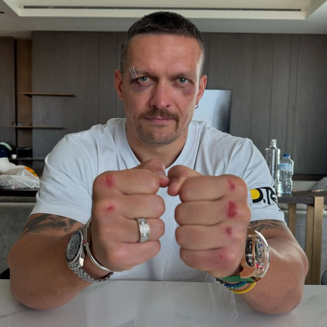 Oleksandr Usyk seated at a table with both fists extended toward the camera and a dressing above his right eye.