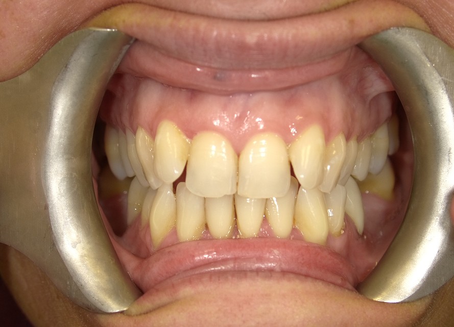 Before Image