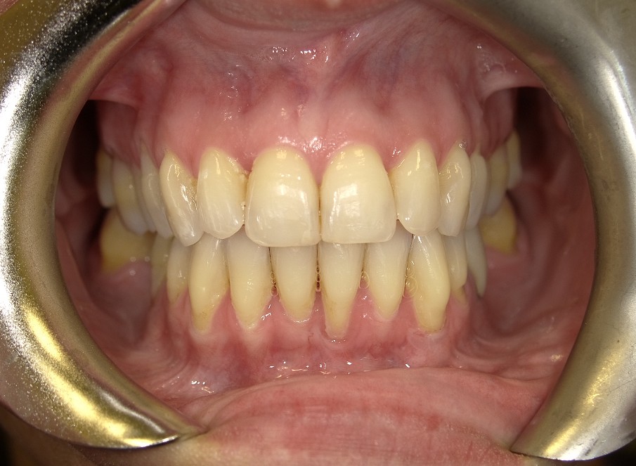 After Image