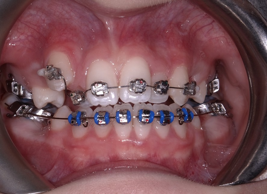 Before Image