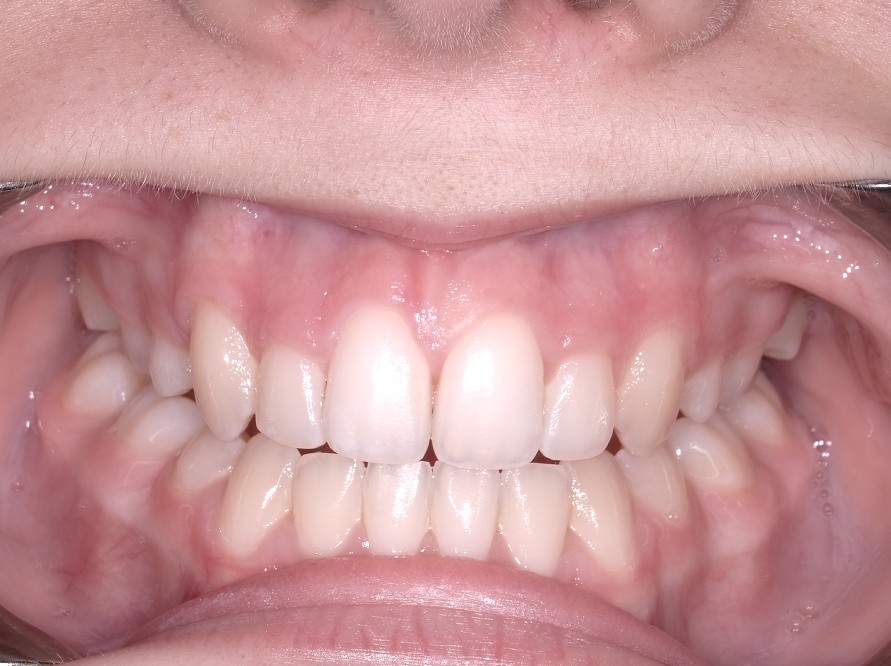 After Image