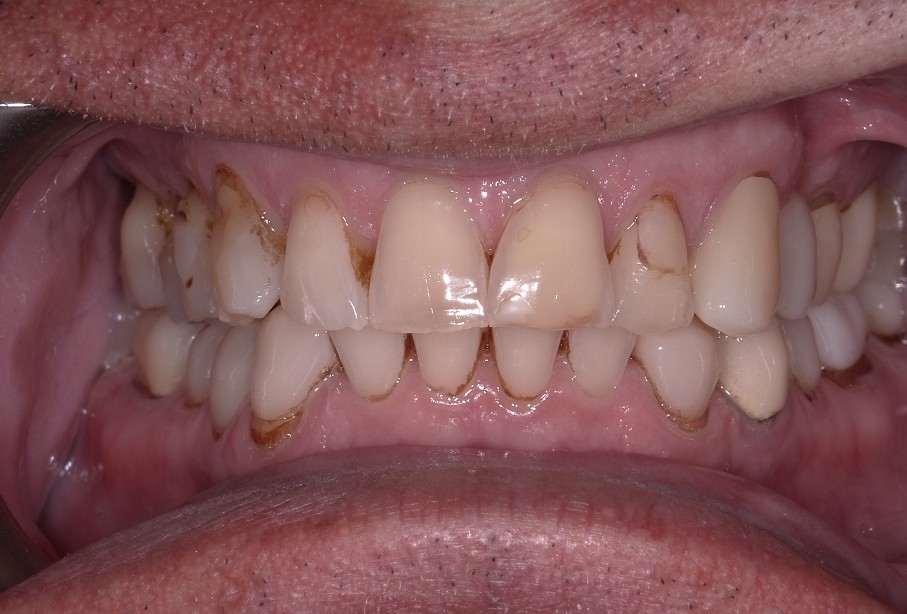 Before Image