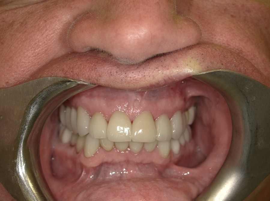 After Image