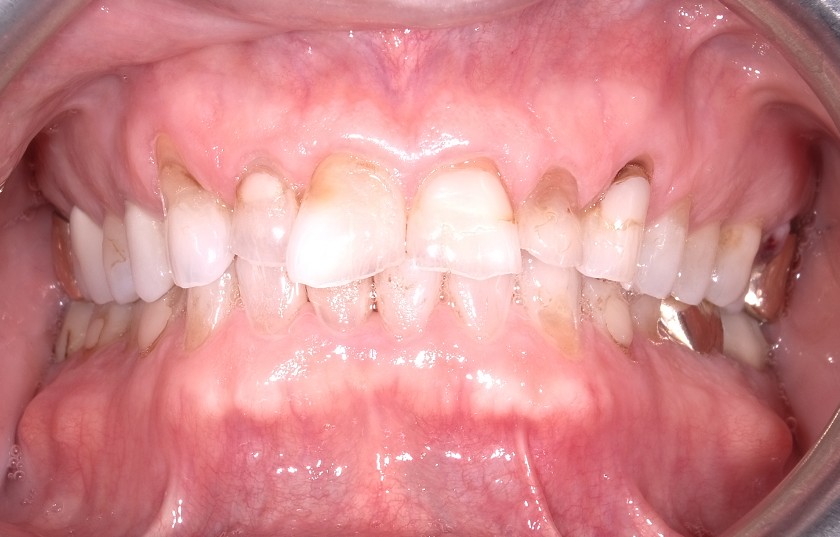 Before Image