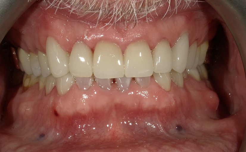 After Image