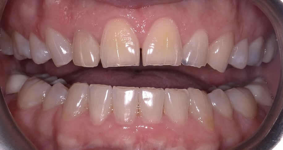 Before Image