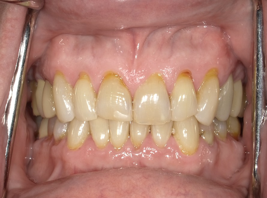 Before Image