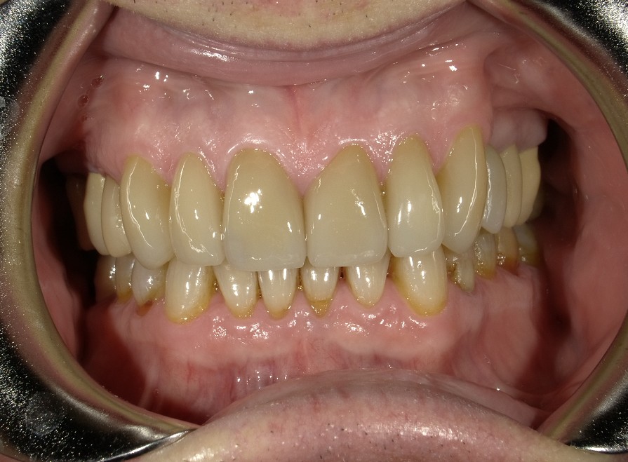 After Image