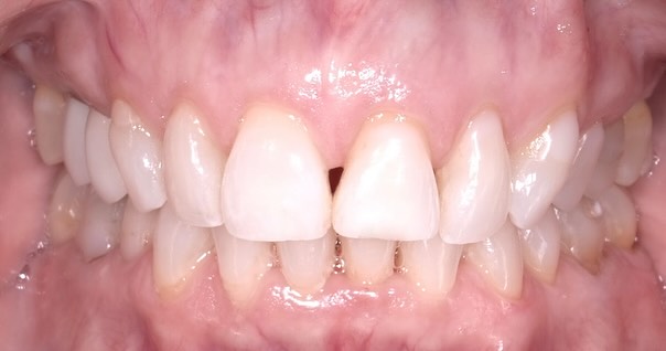 After Image