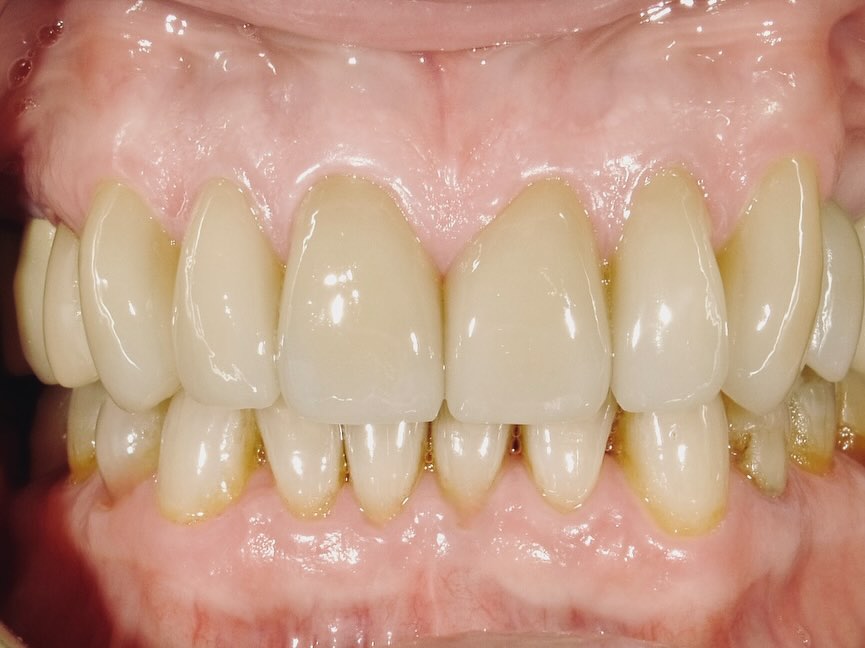 After Image