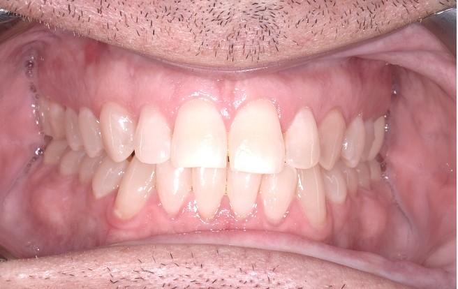 Before Image