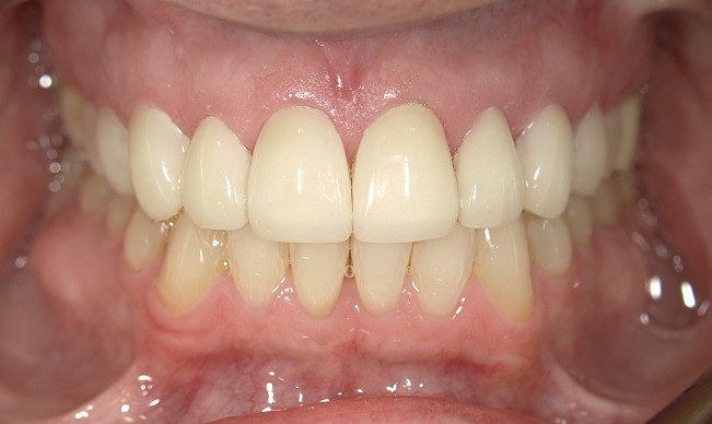 After Image