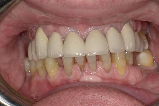 Before Image