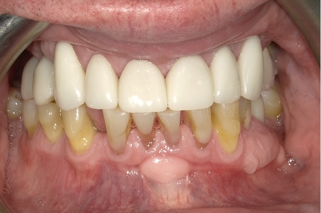 After Image