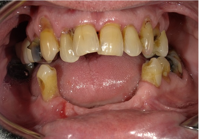 Before Image