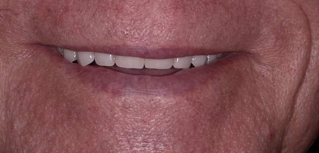After Image