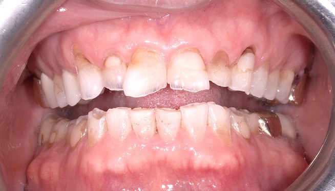 Before Image