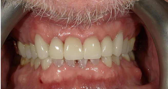 After Image