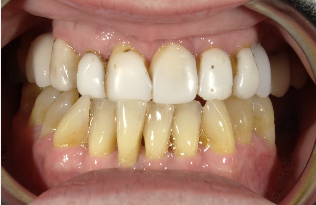 Before Image