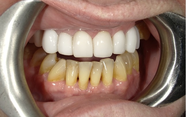 After Image