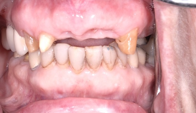 Before Image