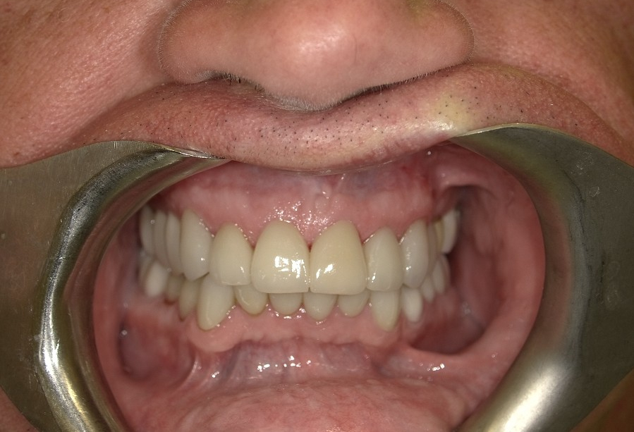 After Image
