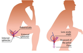 The Proper Way To Poop | The Chiropractic Office & Health Associates