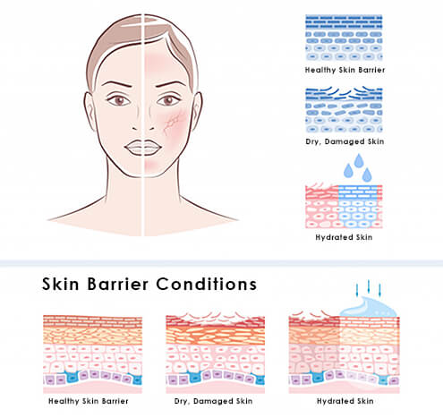 Importance Of Skin Hydration For Glowing Skin