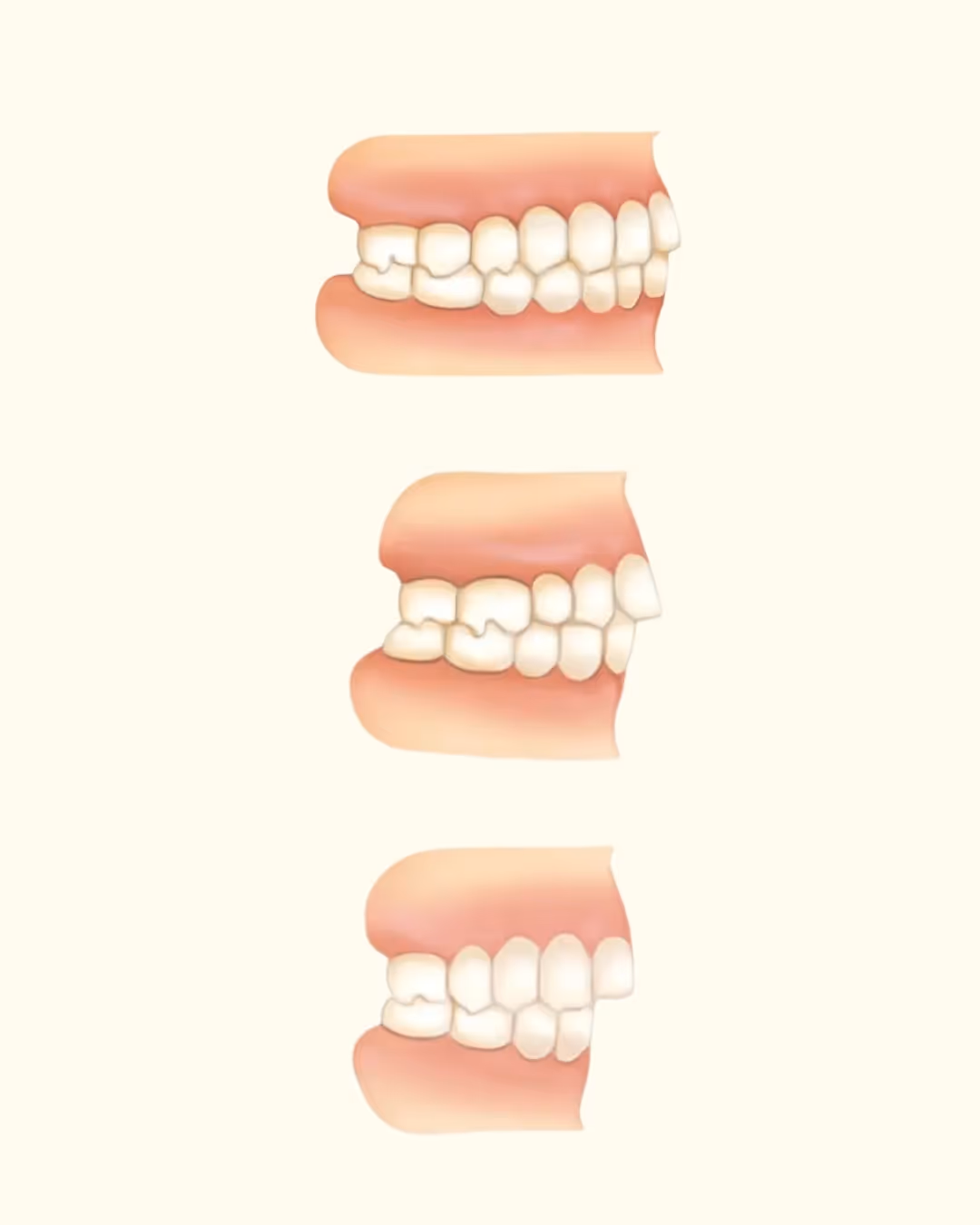 зъби на жълт фон