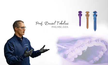 Токолини в синя манта и мини импланти шарени