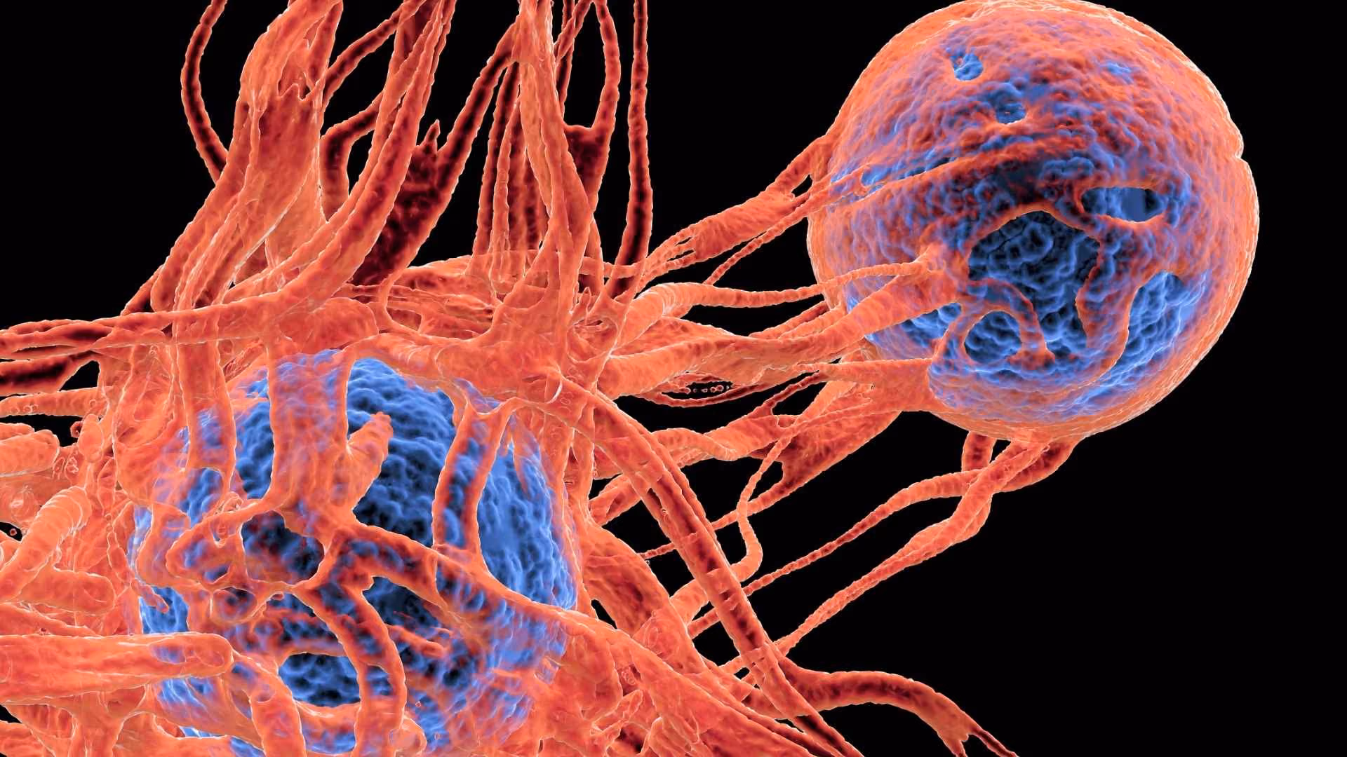 A cancer cell
